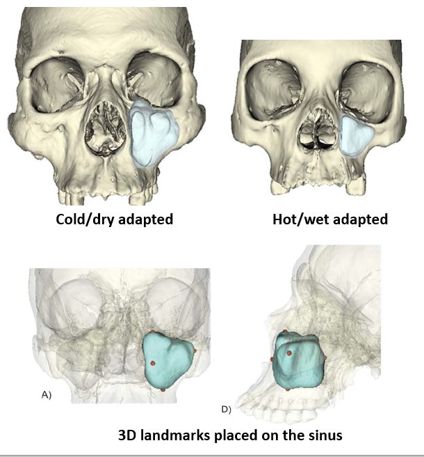 scanned skulls