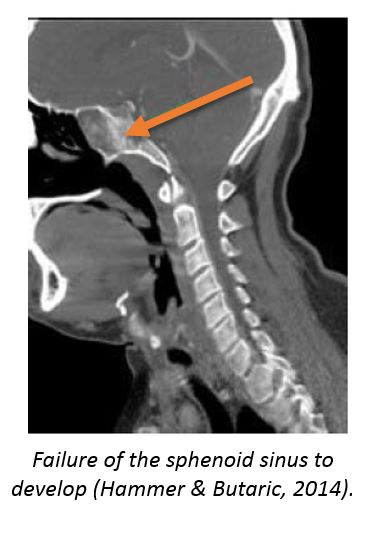 scan of skull and throat